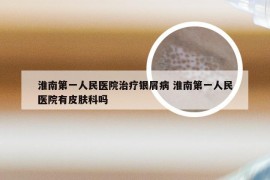 淮南第一人民医院治疗银屑病 淮南第一人民医院有皮肤科吗