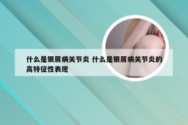 什么是银屑病关节炎 什么是银屑病关节炎的高特征性表现