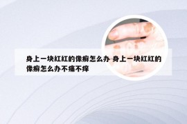 身上一块红红的像癣怎么办 身上一块红红的像癣怎么办不痛不痒