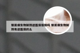 银屑病生物制剂进医保报销吗 银屑病生物制剂有进医保的么