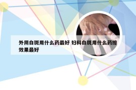 外阴白斑用什么药最好 妇科白斑用什么药擦效果最好