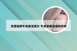 百度贴吧牛皮癣泡澡方 牛皮肤癣泡澡的药材