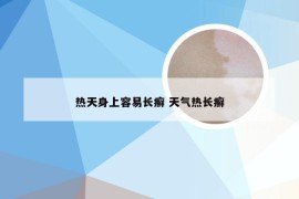 热天身上容易长癣 天气热长癣