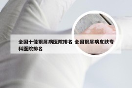 全国十佳银屑病医院排名 全国银屑病皮肤专科医院排名