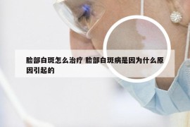 脸部白斑怎么治疗 脸部白斑病是因为什么原因引起的