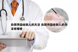 白斑传染给别人的方法 白斑传染给别人的方法有哪些