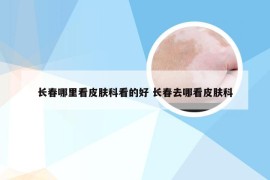 长春哪里看皮肤科看的好 长春去哪看皮肤科