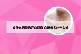 吃什么药能治好白颠疯 白颠疯多吃什么好