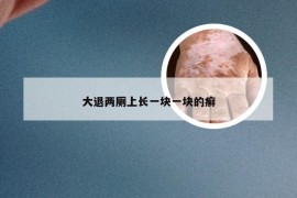 大退两厕上长一块一块的癣