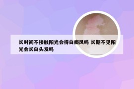 长时间不接触阳光会得白癜风吗 长期不见阳光会长白头发吗