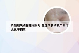 陈醋加风油精能治癣吗 醋加风油精会产生什么化学物质