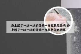 身上起了一块一块的像癣一样红色能治吗 身上起了一块一块的像癣一样红色怎么回事