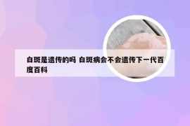 白斑是遗传的吗 白斑病会不会遗传下一代百度百科