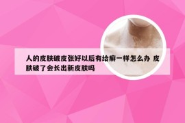 人的皮肤破皮张好以后有给癣一样怎么办 皮肤破了会长出新皮肤吗