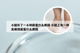 小腿长了一小块藓是什么原因 小腿上有一块皮癣到底是什么原因