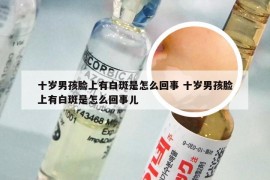 十岁男孩脸上有白斑是怎么回事 十岁男孩脸上有白斑是怎么回事儿