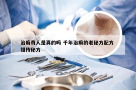 治癣奇人是真的吗 千年治癣的老秘方配方 祖传秘方