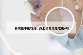 白斑能不能吃维c 身上长白斑能吃维e吗