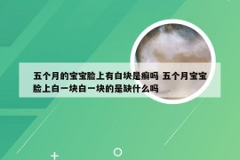 五个月的宝宝脸上有白块是癣吗 五个月宝宝脸上白一块白一块的是缺什么吗