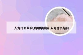 人为什么长癣,病理学原因 人为什么起藓