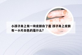 小孩子身上有一块皮肤白了是 孩子身上皮肤有一小片白色的是什么?