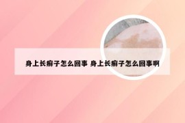 身上长癣子怎么回事 身上长癣子怎么回事啊