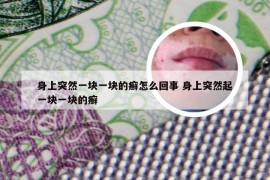 身上突然一块一块的癣怎么回事 身上突然起一块一块的癣