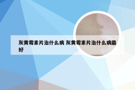 灰黄霉素片治什么病 灰黄霉素片治什么病最好