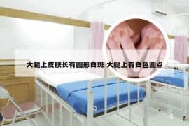 大腿上皮肤长有圆形白斑 大腿上有白色圆点