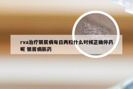 rva治疗银屑病每日两粒什么时候正确停药呢 银屑病新药