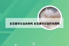 无花果可以治白斑吗 无花果可以治疗白斑吗