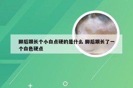 脚后跟长个小白点硬的是什么 脚后跟长了一个白色硬点