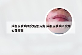 成都皮肤病研究所怎么走 成都皮肤病研究中心在哪里