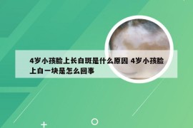 4岁小孩脸上长白斑是什么原因 4岁小孩脸上白一块是怎么回事