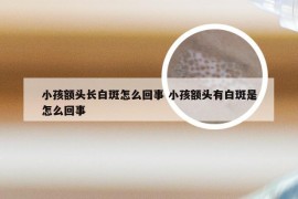 小孩额头长白斑怎么回事 小孩额头有白斑是怎么回事