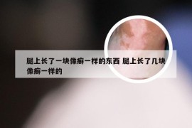 腿上长了一块像癣一样的东西 腿上长了几块像癣一样的