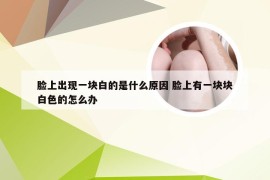 脸上出现一块白的是什么原因 脸上有一块块白色的怎么办