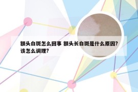 额头白斑怎么回事 额头长白斑是什么原因?该怎么调理?