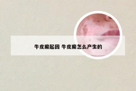 牛皮廨起因 牛皮廨怎么产生的