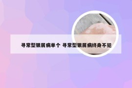 寻常型银屑病单个 寻常型银屑病终身不犯