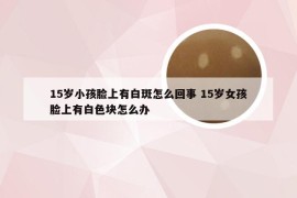 15岁小孩脸上有白斑怎么回事 15岁女孩脸上有白色块怎么办