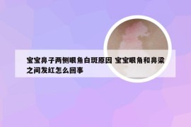 宝宝鼻子两侧眼角白斑原因 宝宝眼角和鼻梁之间发红怎么回事