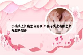 小孩头上长癣怎么回事 小孩子头上有癣怎么办越长越多