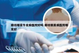 廊坊哪家牛皮癣医院好吗 廊坊银屑病医院哪家好