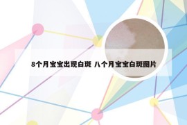 8个月宝宝出现白斑 八个月宝宝白斑图片