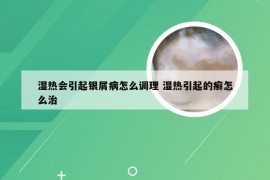 湿热会引起银屑病怎么调理 湿热引起的癣怎么治