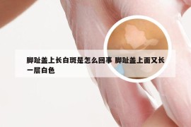 脚趾盖上长白斑是怎么回事 脚趾盖上面又长一层白色