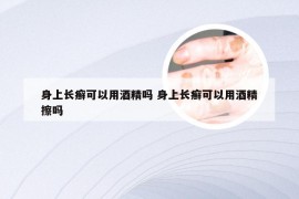 身上长癣可以用酒精吗 身上长癣可以用酒精擦吗