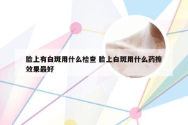 脸上有白斑用什么检查 脸上白斑用什么药擦效果最好