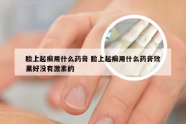 脸上起癣用什么药膏 脸上起癣用什么药膏效果好没有激素的